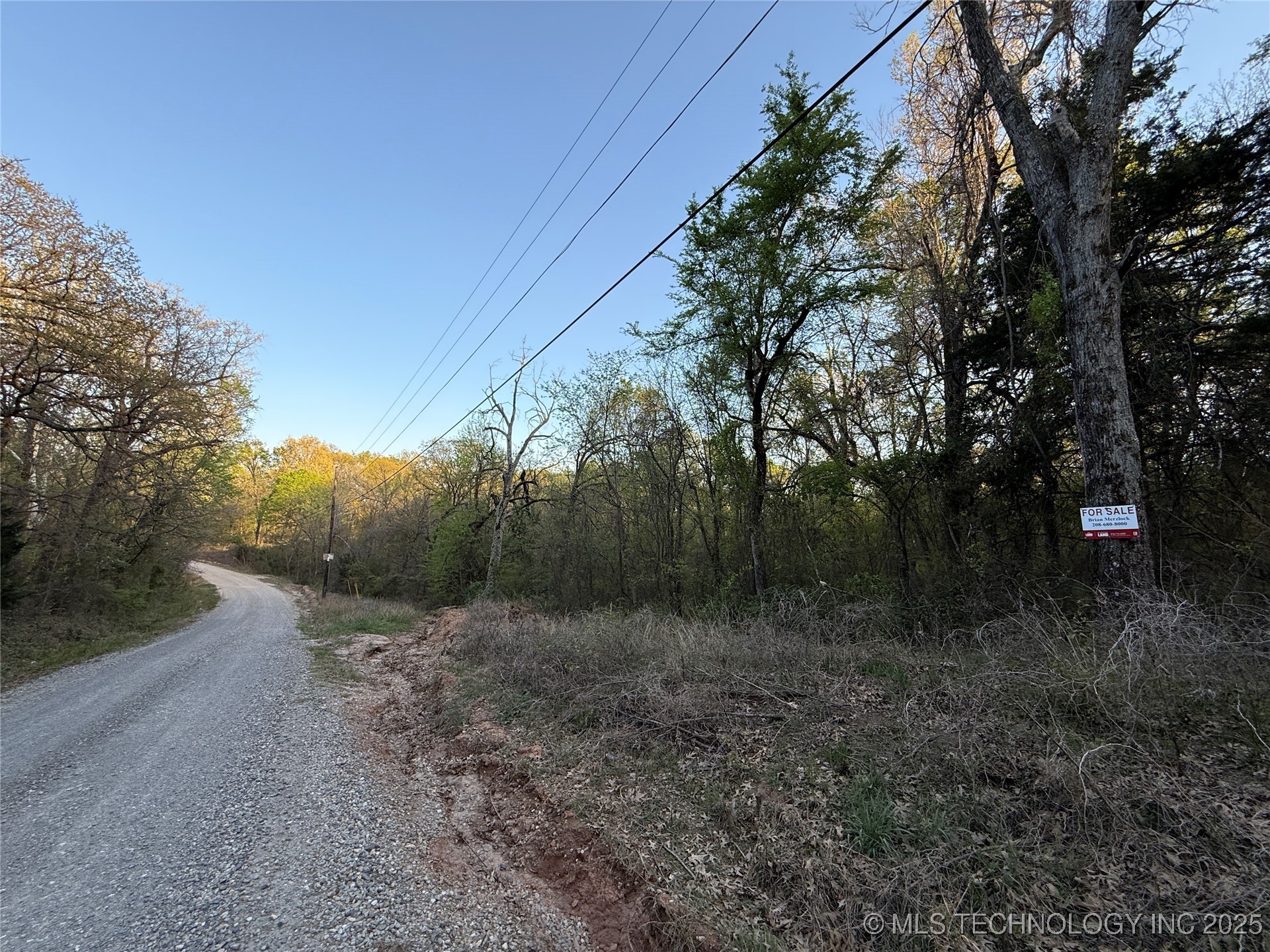 20 E Lakeview Road Property Photo 10