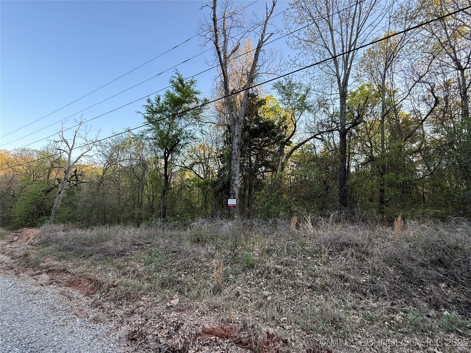 20 E Lakeview Road Property Photo 11