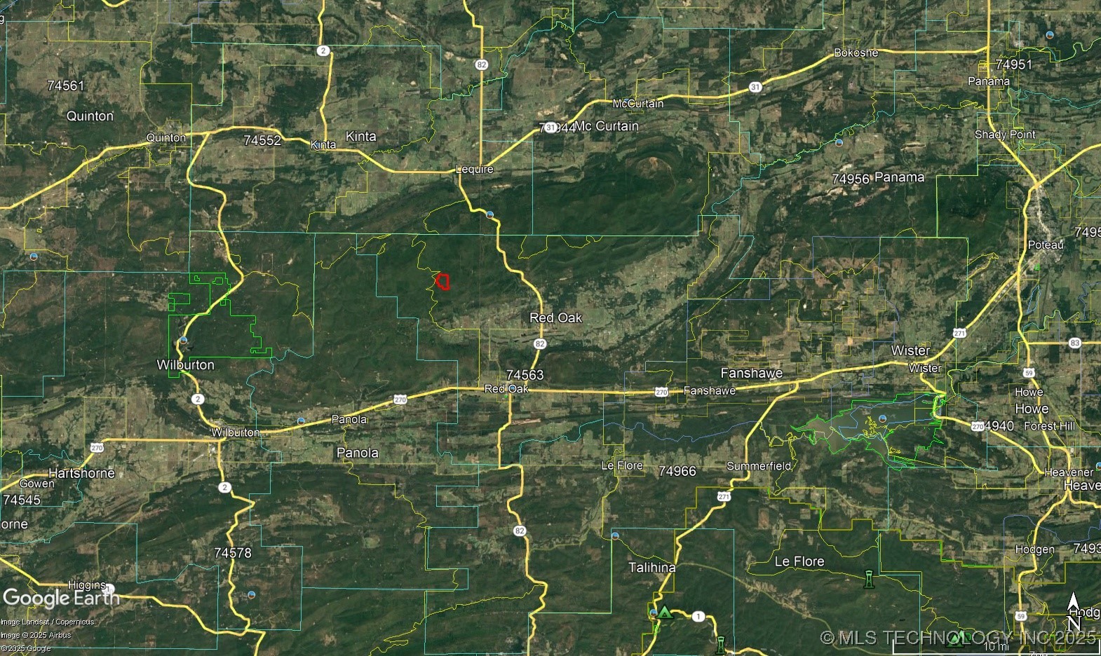 Ne 155th Street Property Photo 65